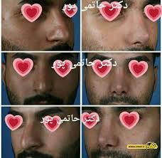 بهترین جراح بینی در شیراز