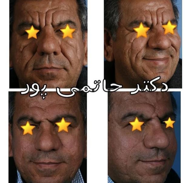 بهترین جراح بینی در شیراز