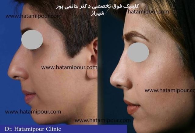 بهترین جراح بینی در شیراز