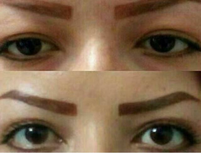 بهترین جراح بینی در شیراز