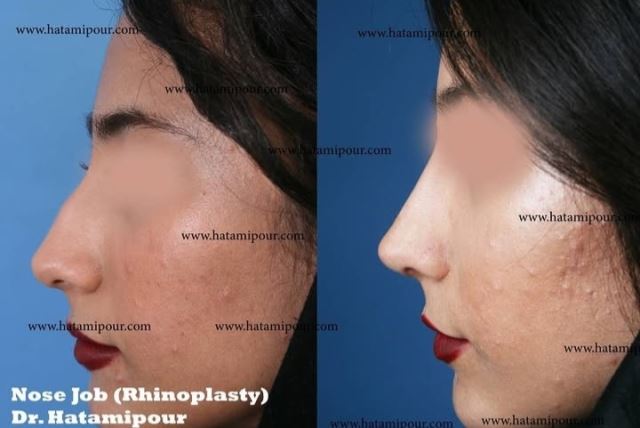بهترین جراح بینی در شیراز