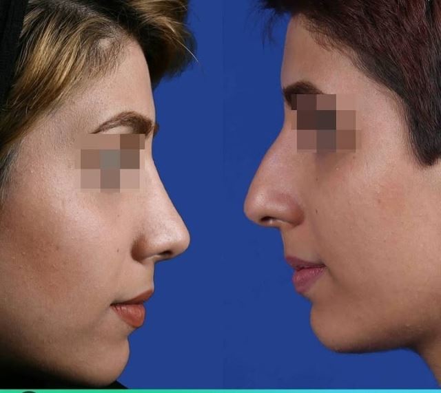 بهترین جراح بینی در شیراز