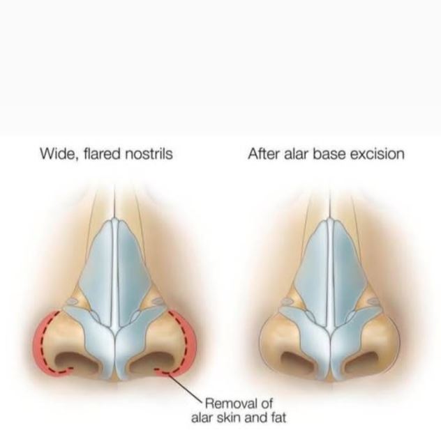 بهترین جراح بینی در شیراز