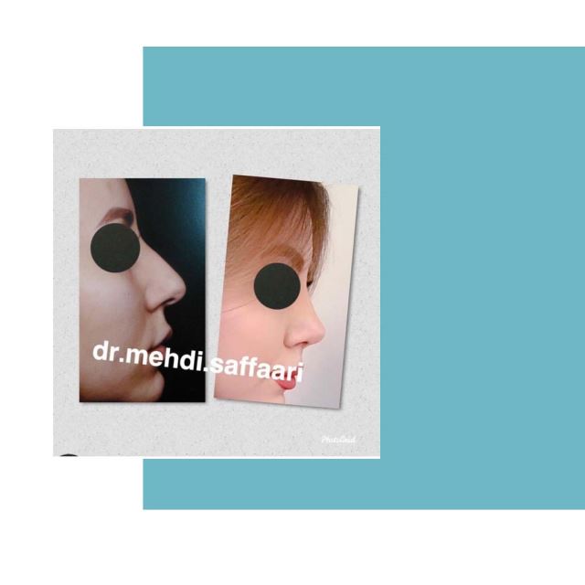 بهترین جراح بینی اصفهان