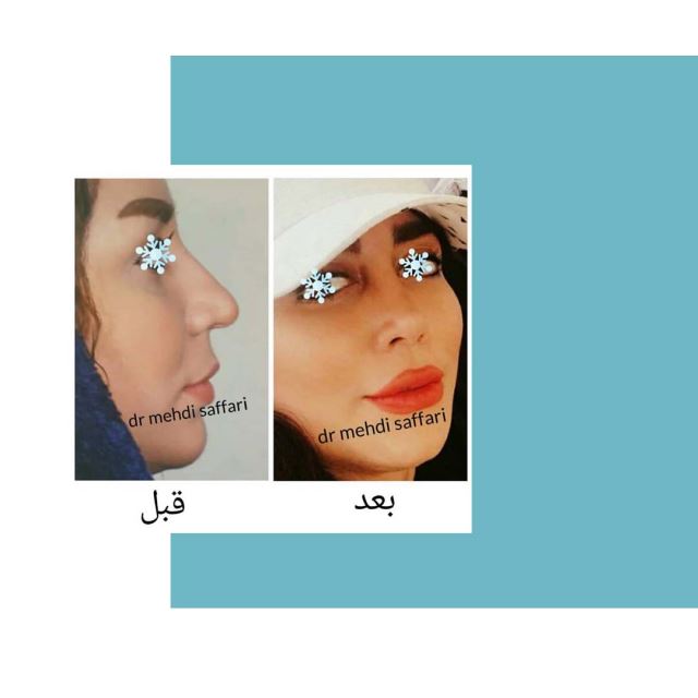 بهترین جراح بینی اصفهان