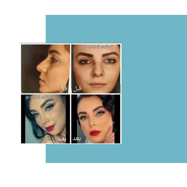 بهترین جراح بینی اصفهان