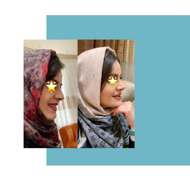 بهترین جراح بینی اصفهان