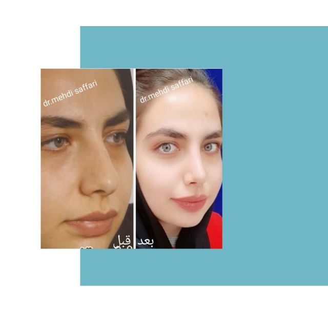 بهترین جراح بینی اصفهان