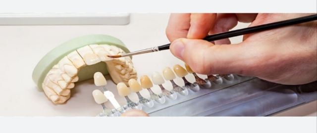 دندانسازی مینا