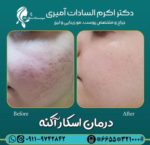 اسکار جوش