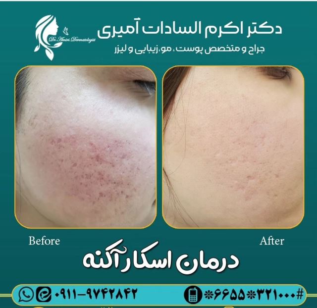 اسکار جوش