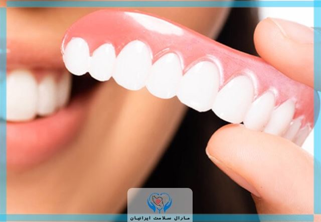 دندان فک بالا