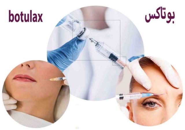 بوتاکس بوتولاکس