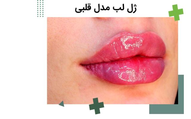 ژل لب قلبی