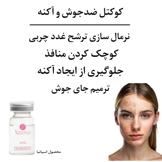 لاین آکنه