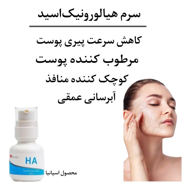 لاین آبرسانی