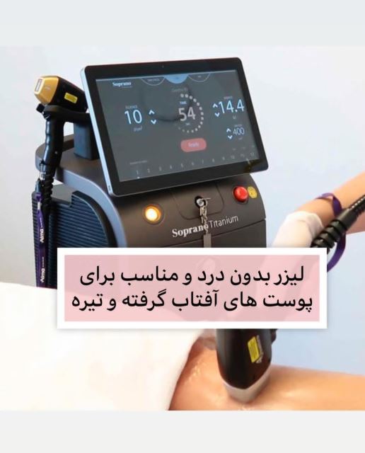 لیزردایور کل دست خانم ها