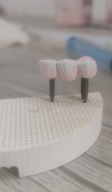 پرسلن گذاری