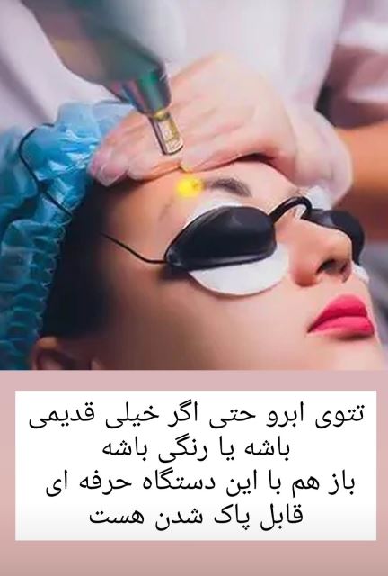 پاک کردن تتو ابرو