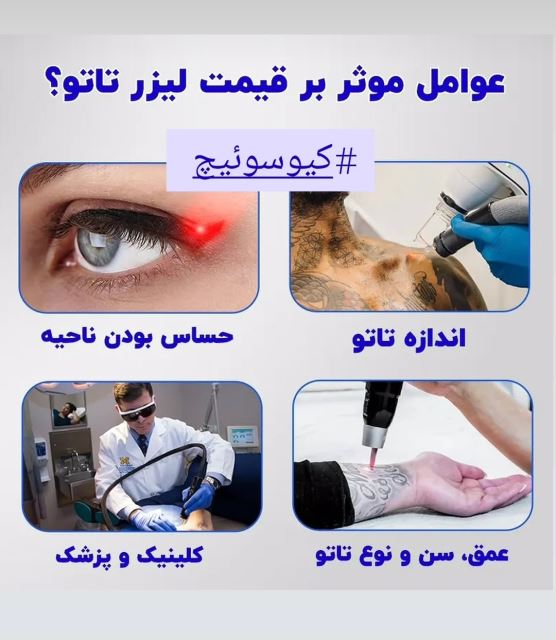 معرفی دستگاه کیوسوئیچ