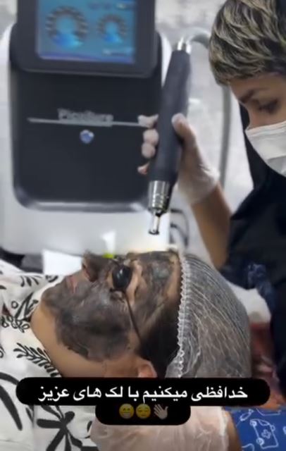 روشن کردن پوست,ازبین بردن منافذ پوست ولک های صورت