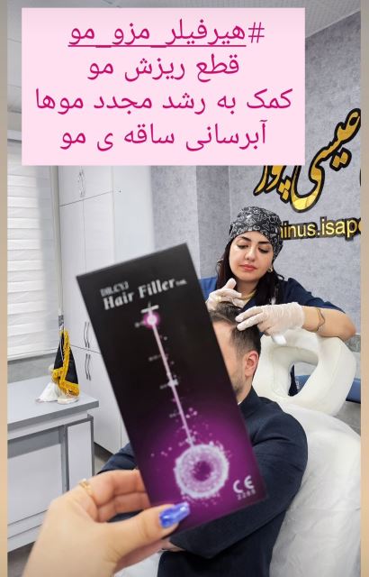 هیرفیلر,مزو_مو