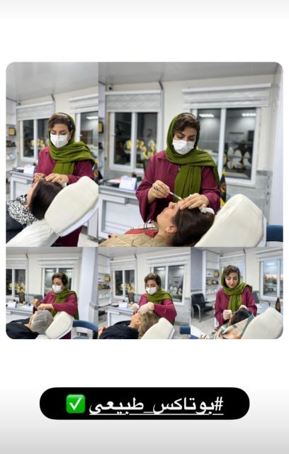 بوتاکس طبیعی