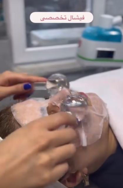 فیشیال تخصصی