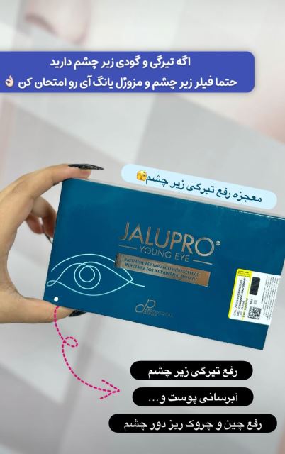 جالپرو_مزوژل یانگ آی