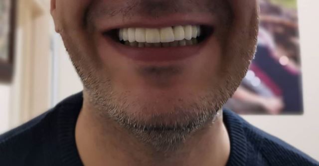 لابراتوار تخصصی پروتز پارسا