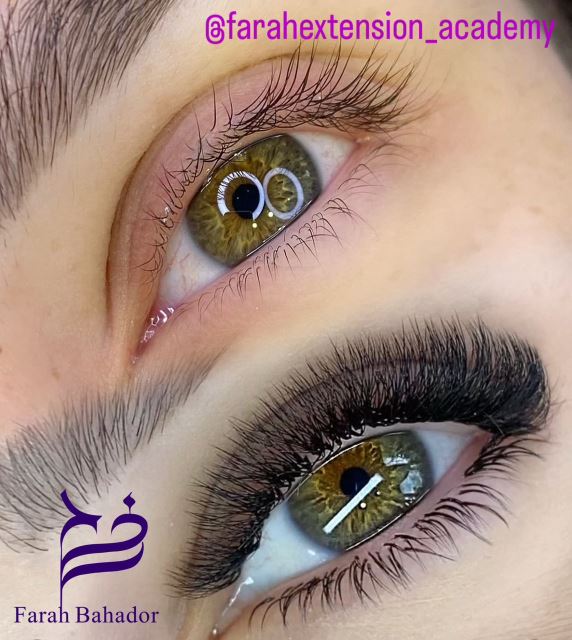 کاشت و ترمیم مژه در اقدسیه