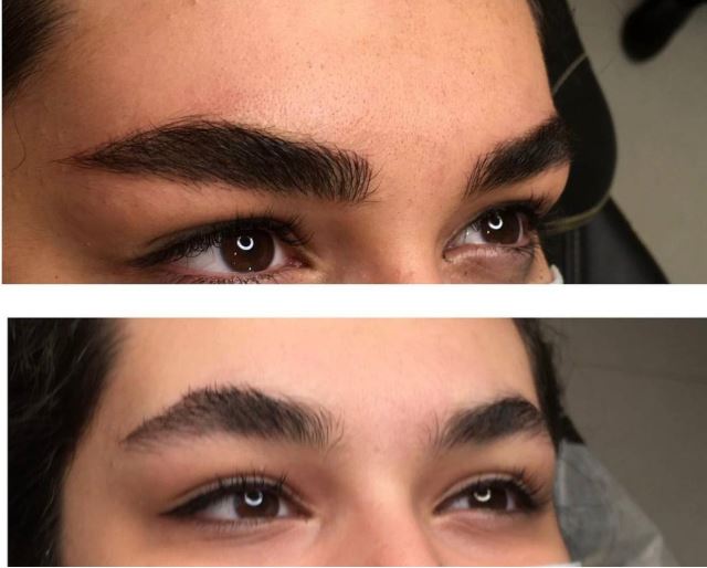 خدمات تاتو و ریمو