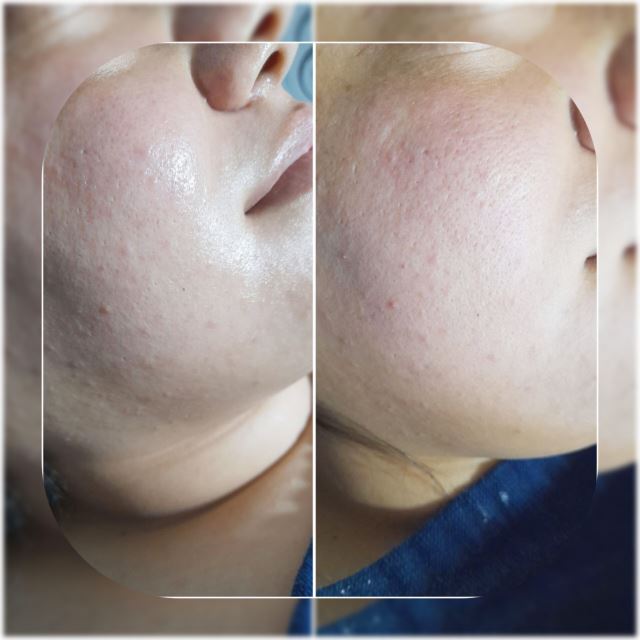 پکیج کلاسیک