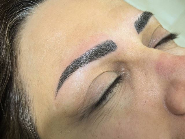 فیبروز ابرو