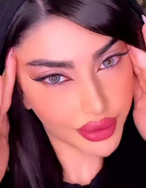 کاشت مژه موقت