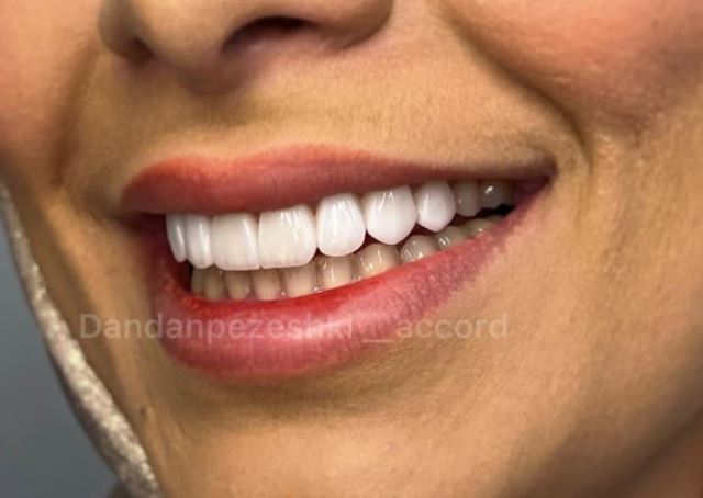 دندانپزشکی آکورد