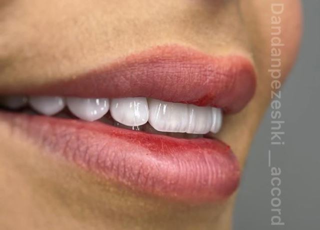 وام دندانپزشکی در اصفهان