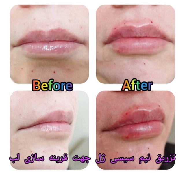 خدمات زیبایی