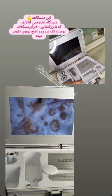 خدمات اسکالپ تیریتمنت