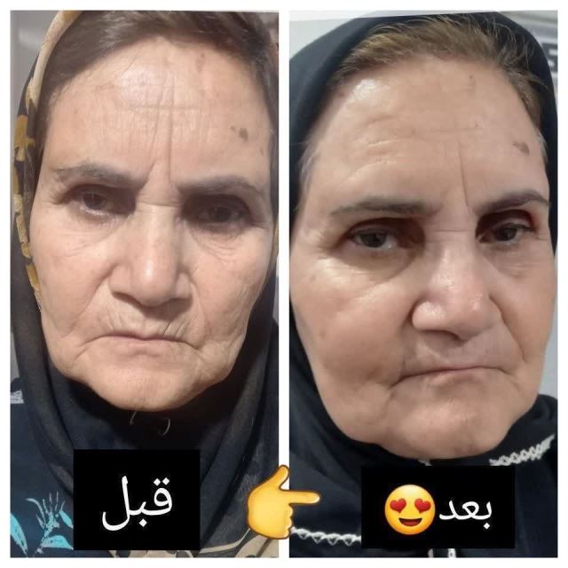 درمان شده و رضایت