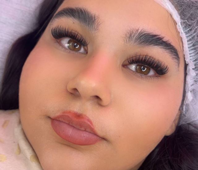 خدمات کاشت موقت