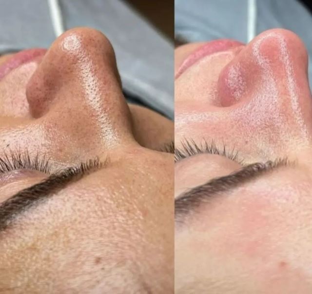 خدمات فشیال 😍 