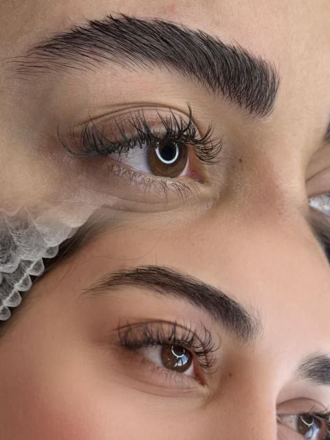 میکروبلیدینگ