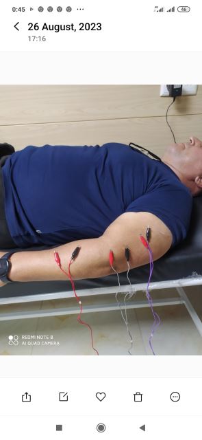 انجام طب سوزنی